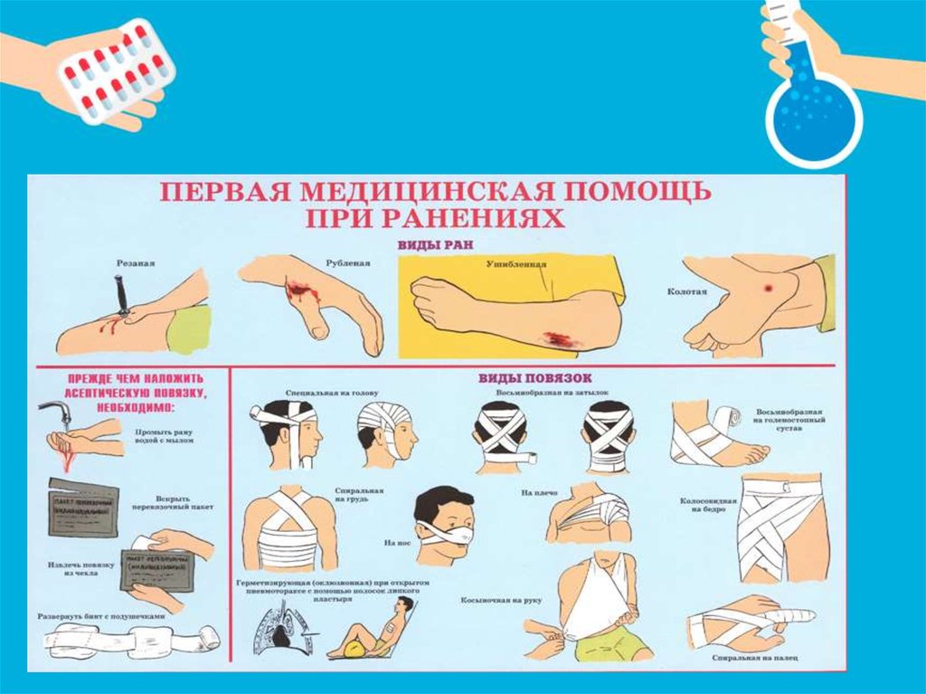 Первая помощь при ранениях презентация обж