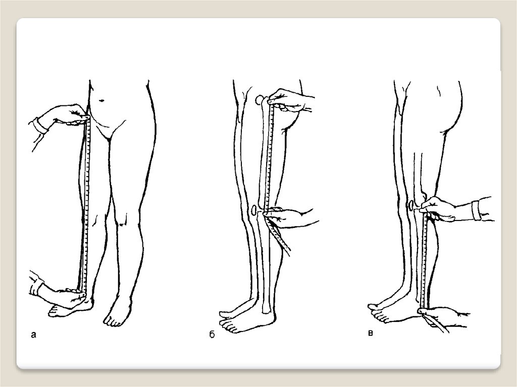 Как узнать ног. Антропометрия измерение конечности. Антропометрия измерение длины конечностей. Измерение окружности конечности. Измерение длины ног в ортопедии.