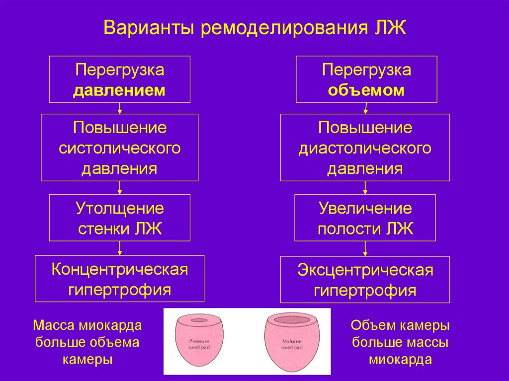 Перегрузка сердца. Перегрузка сердца давлением. Перегрузка сердца объемом и давлением. Перегрузка объемом сердца причины. Перегрузка миокарда объемом.