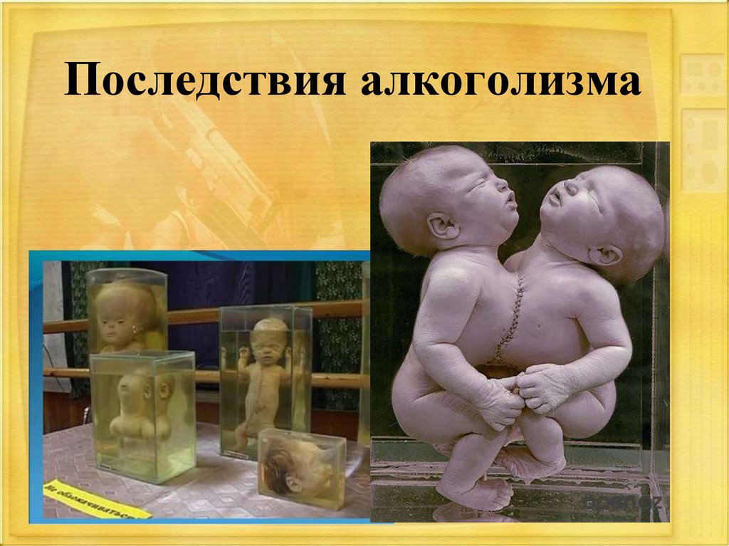 Последствия алкоголизма