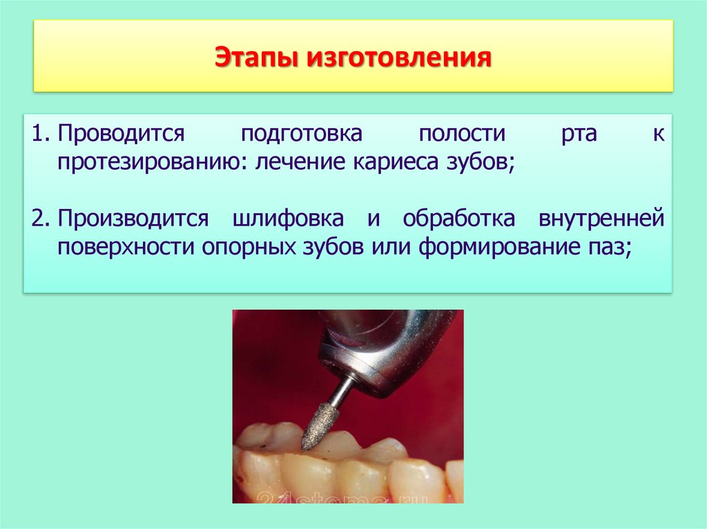 План подготовки к протезированию полости рта