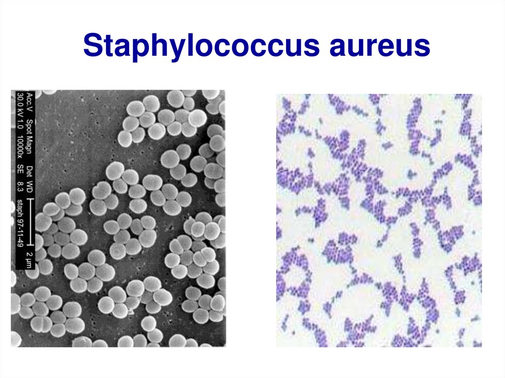 Staphylococcus aureus степени. Стафилококк ауреус микроскопия. Стрептококк ауреус. Staphylococcus aureus микроскопия. Staphylococcus aureus под микроскопом.
