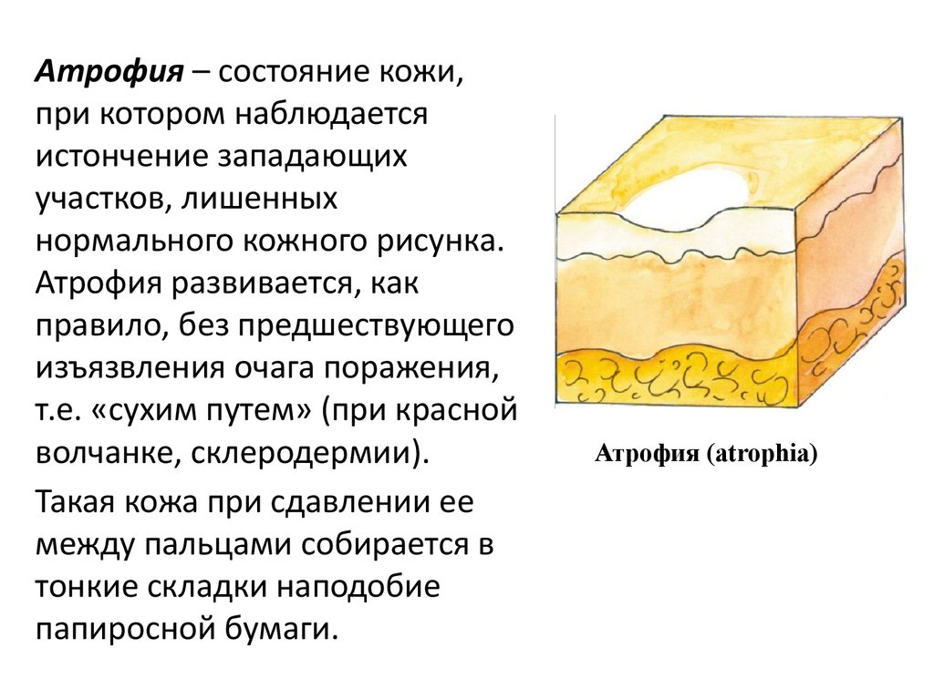 Усиление кожного рисунка