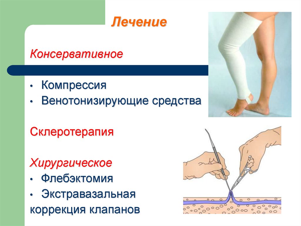 Виды тромбоза. Острый тромбофлебит нижних конечностей карта вызова. Тромбоз нижних конечностей карта вызова. Нарушение венозного кровообращения. Острые нарушения венозного кровообращения.