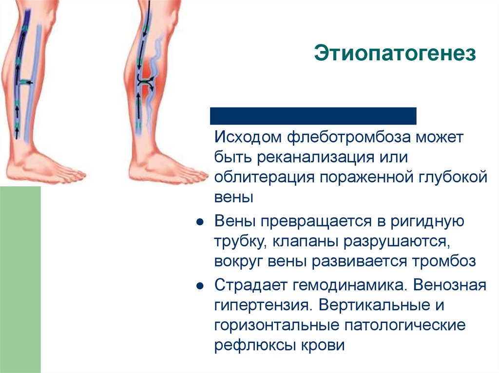 Факторы способствующие венозному кровотоку