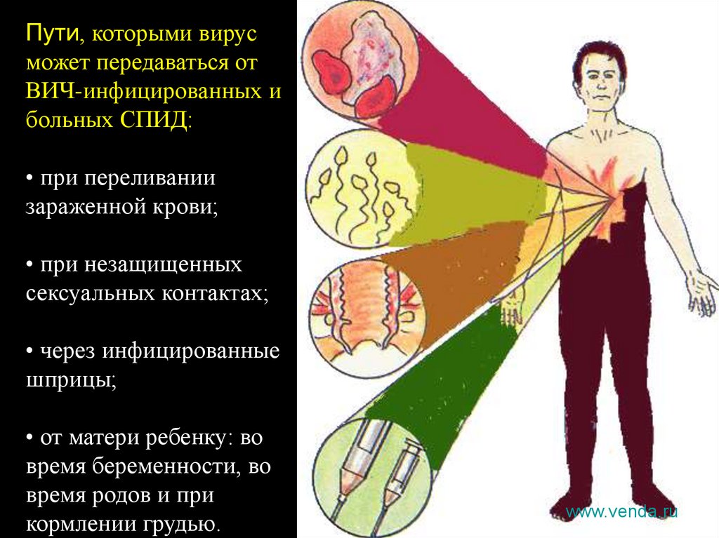 Вич презентация по обж