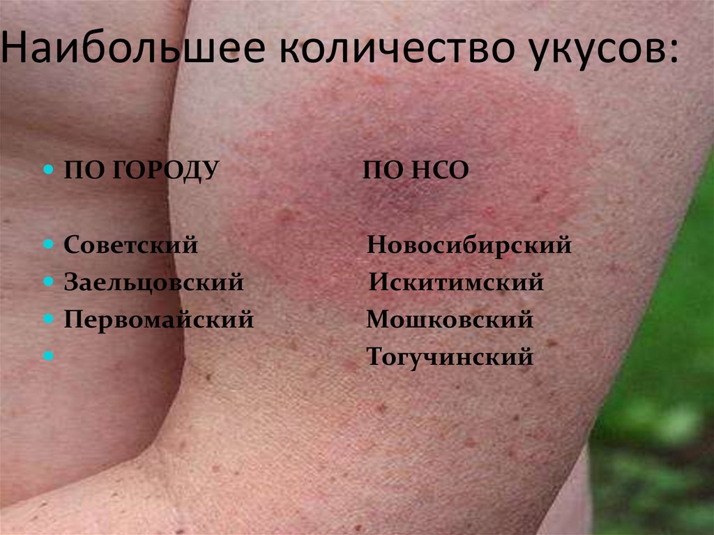 Наибольшее количество укусов: