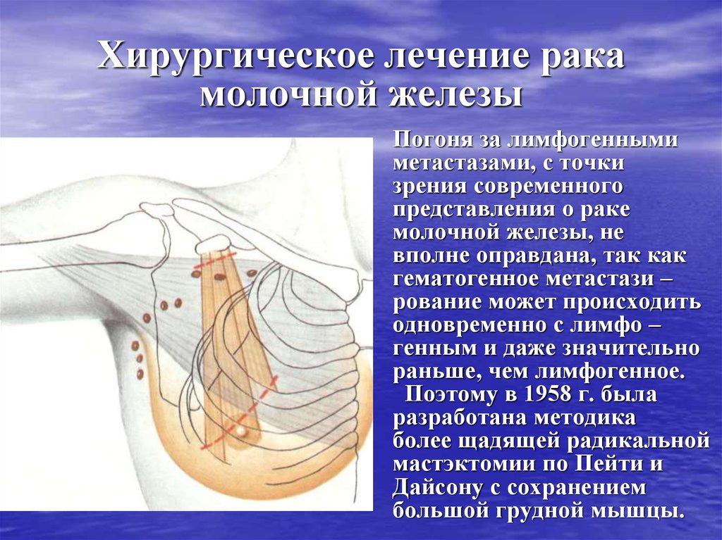 Презентация молочная железа