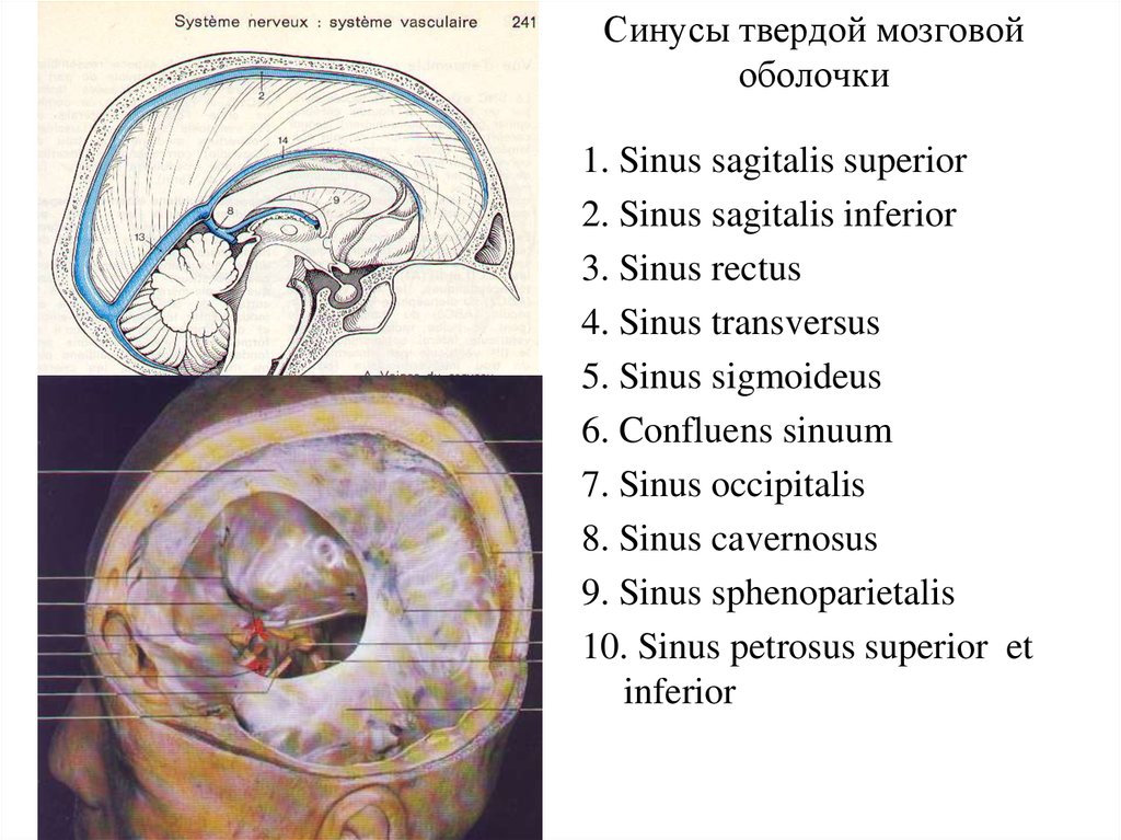Синусы мозга. Пещеристый синус твердой мозговой оболочки. Классификация синусов твердой мозговой оболочки. Синусы твердой оболочки головного мозга анатомия. Сигмовидный синус- Sinus sigmoideus.