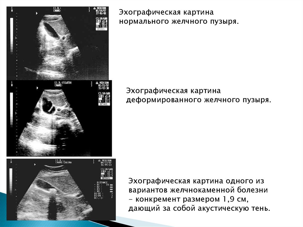 Презентация на тему узи