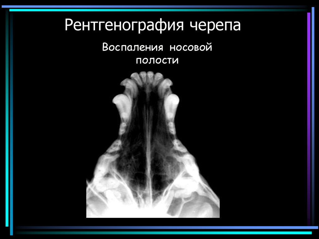 Почему на рентгеновском снимке изображение костей получается белым