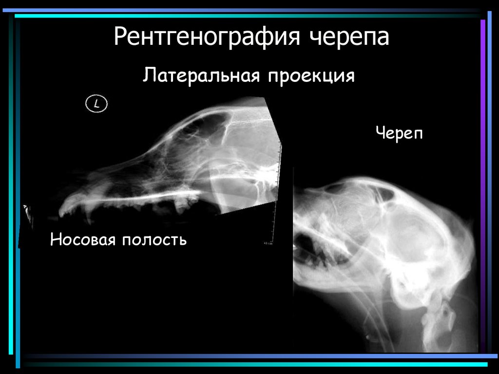 Рентгенография в двух проекциях. Рентгенография это кратко. Рентгенография презентация. Презентация на тему рентгенография.