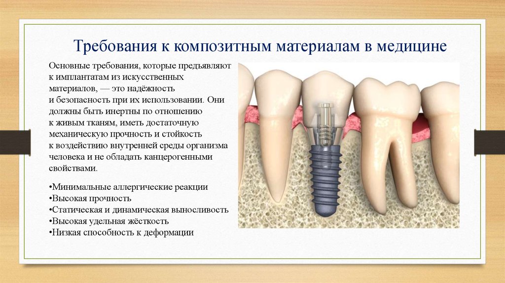 Презентация композиты в стоматологии