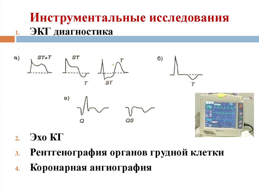 Подготовка к экг. ЭКГ диагностика. Инструментальные исследования ЭКГ. ЭКГ это инструментальное исследование. Данные инструментальных исследований ЭКГ.