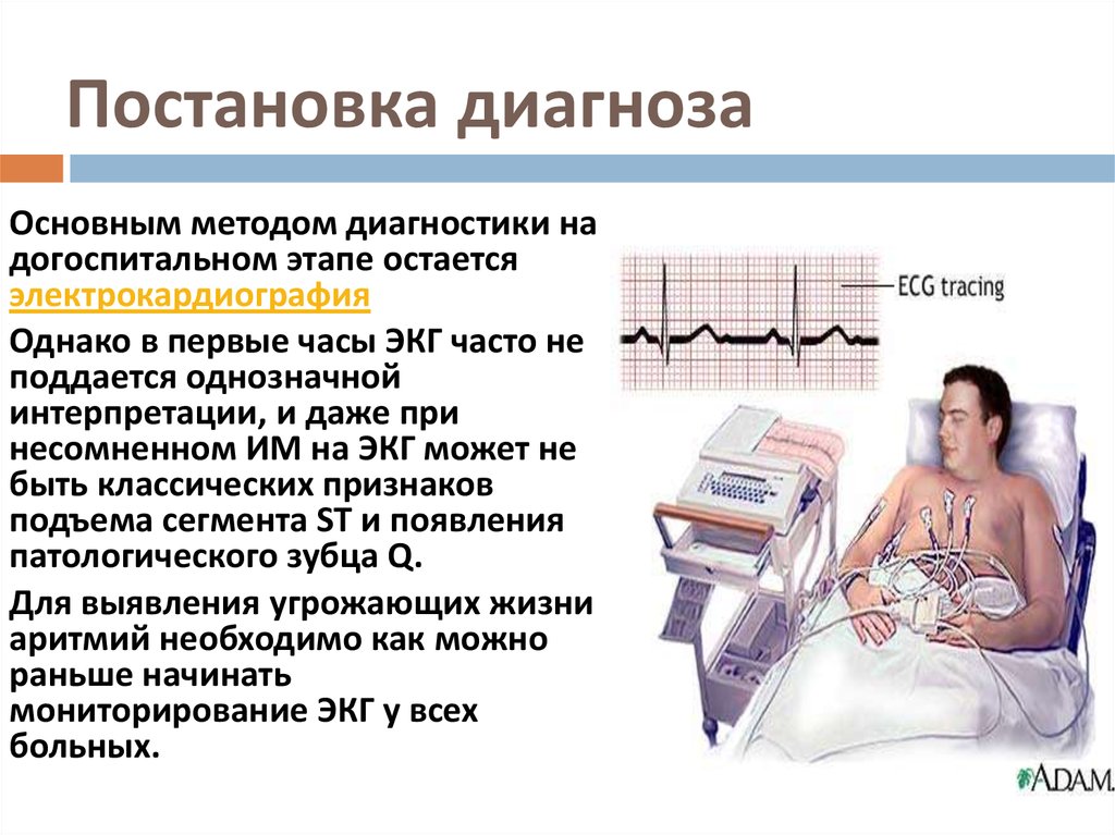 Схема постановки диагноза