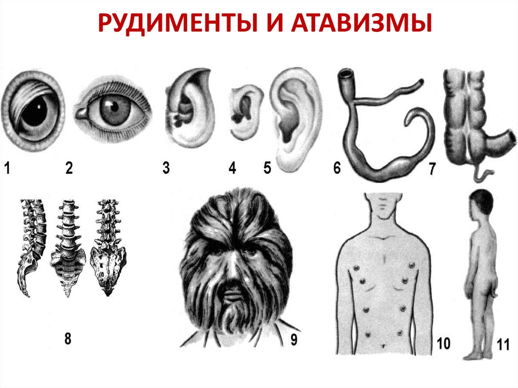 На рисунке под каким номером изображен один из рудиментов человека