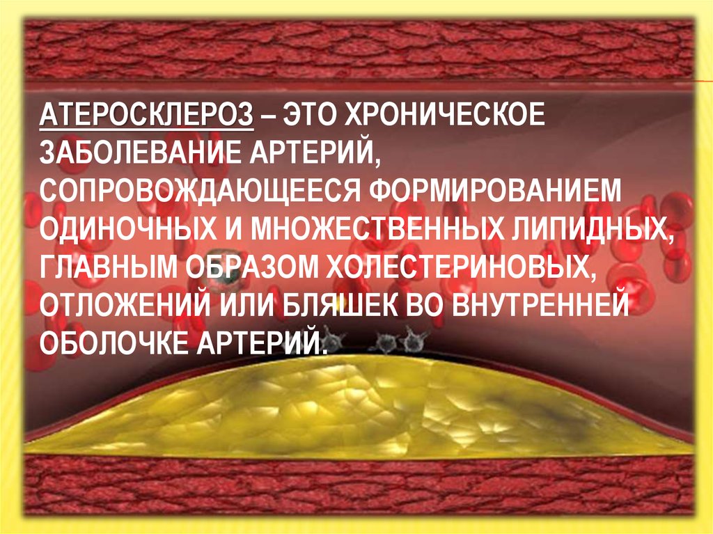 Хронические заболевания артерий. Атеросклероз и профилактика презентация заключение. Атеросклероз это определение 8 класс.