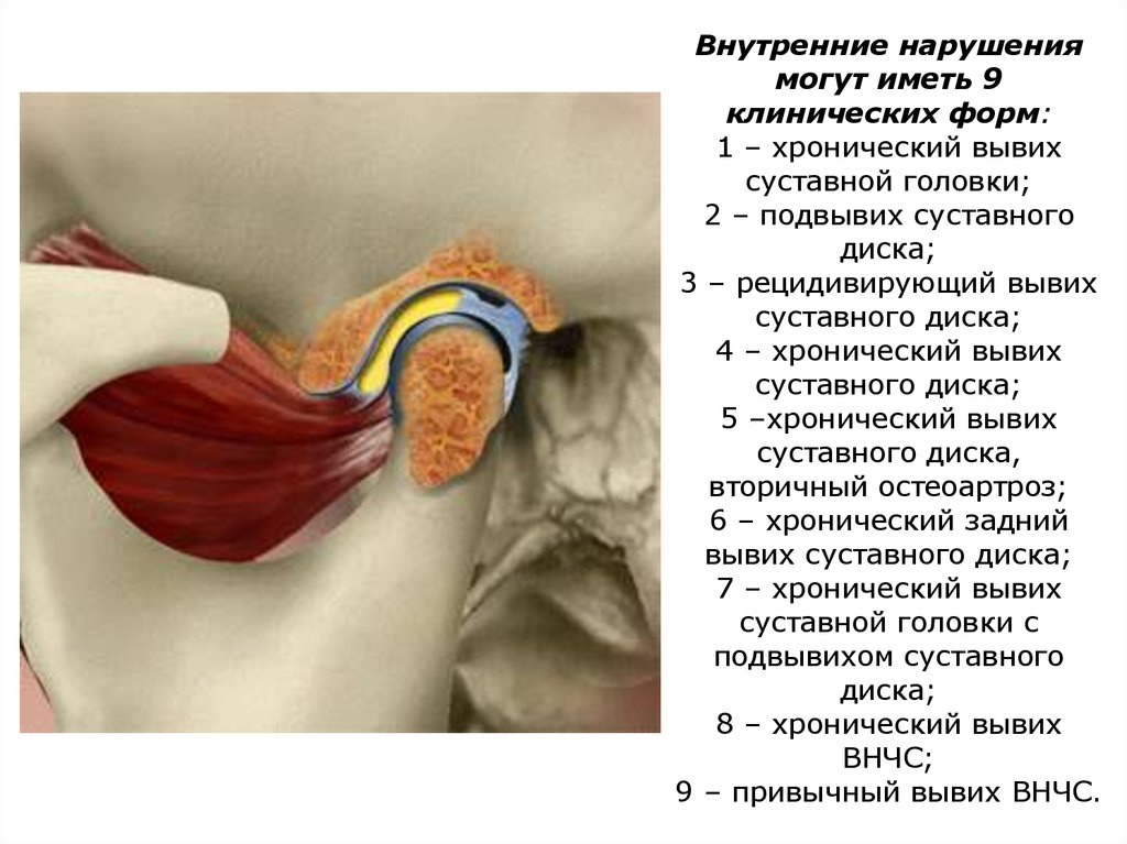 Анатомия внчс презентация