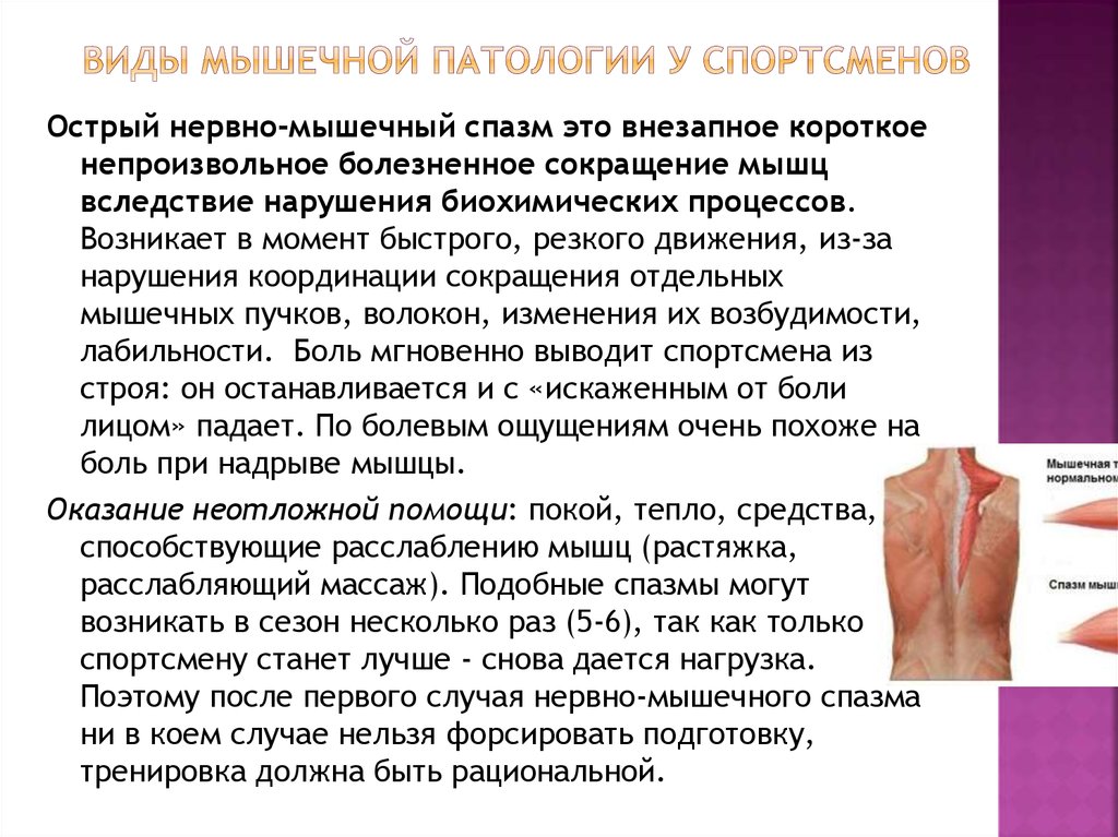 Ослабление мышц. Отсутствие мышц патологическое. ГАЗ В мышцах в патологии.