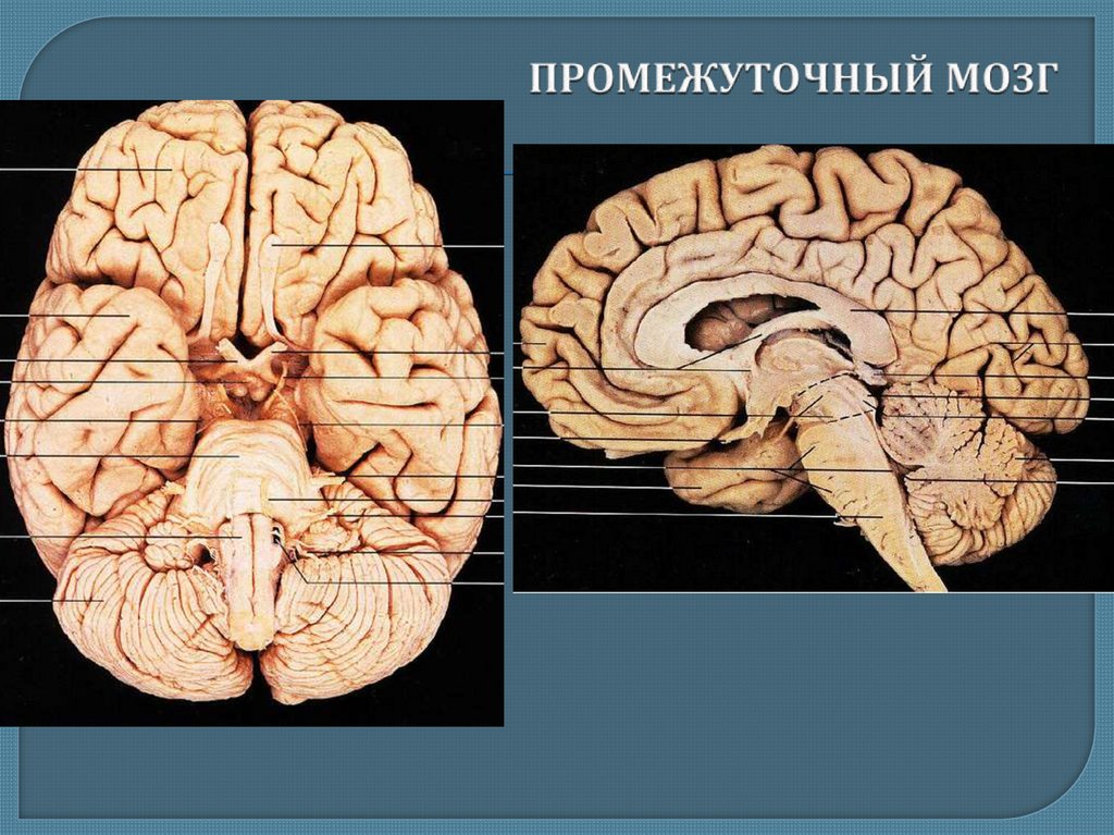 Промежуточный мозг картинка