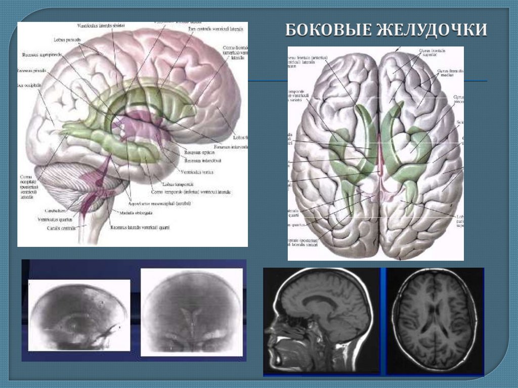Боковые желудочки мозга. Боковые желудочки мозга 4мм. Анатомия плода боковые желудочки мозга мм. Центральная часть бокового желудочка расположена в. Лобные рога боковых желудочков.