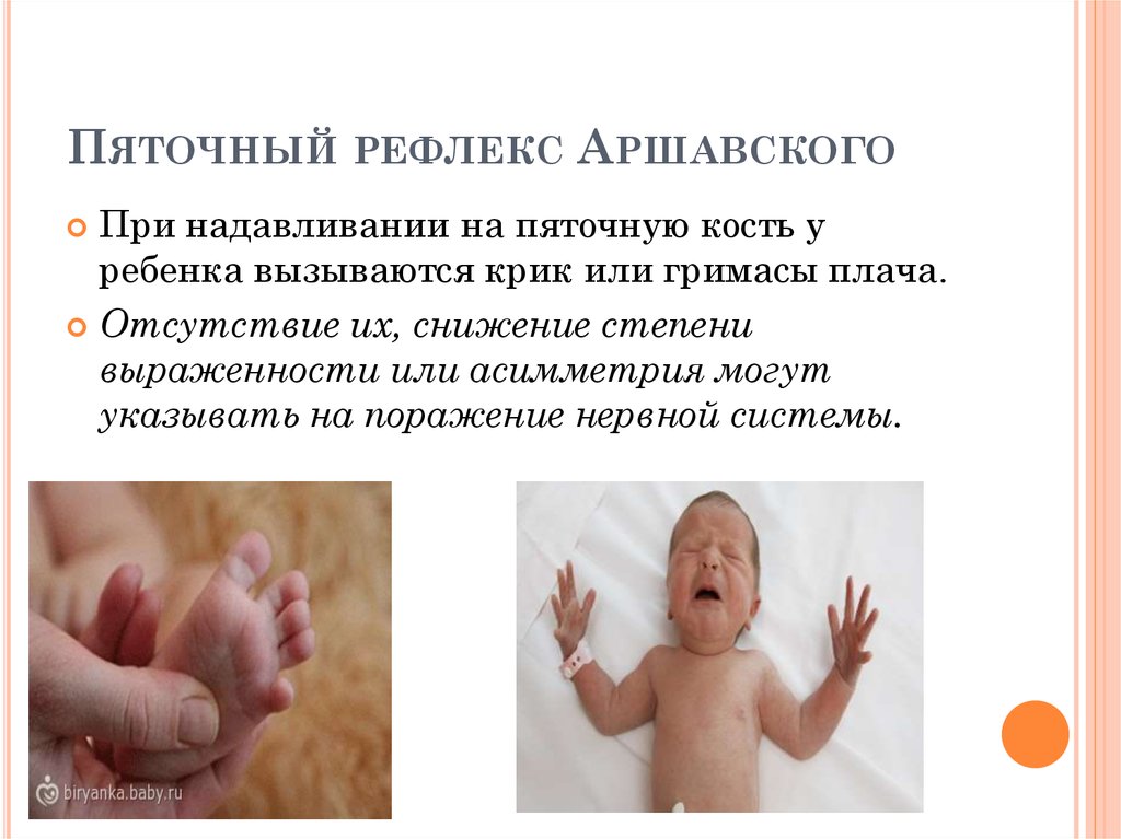 Врожденные какой рефлекс. Пяточный рефлекс у новорожденного. Рефлексы новорожденного Бабинского Моро. Безусловные рефлексы новорожденных. Пяточный рефлекс Аршавского у новорожденных.