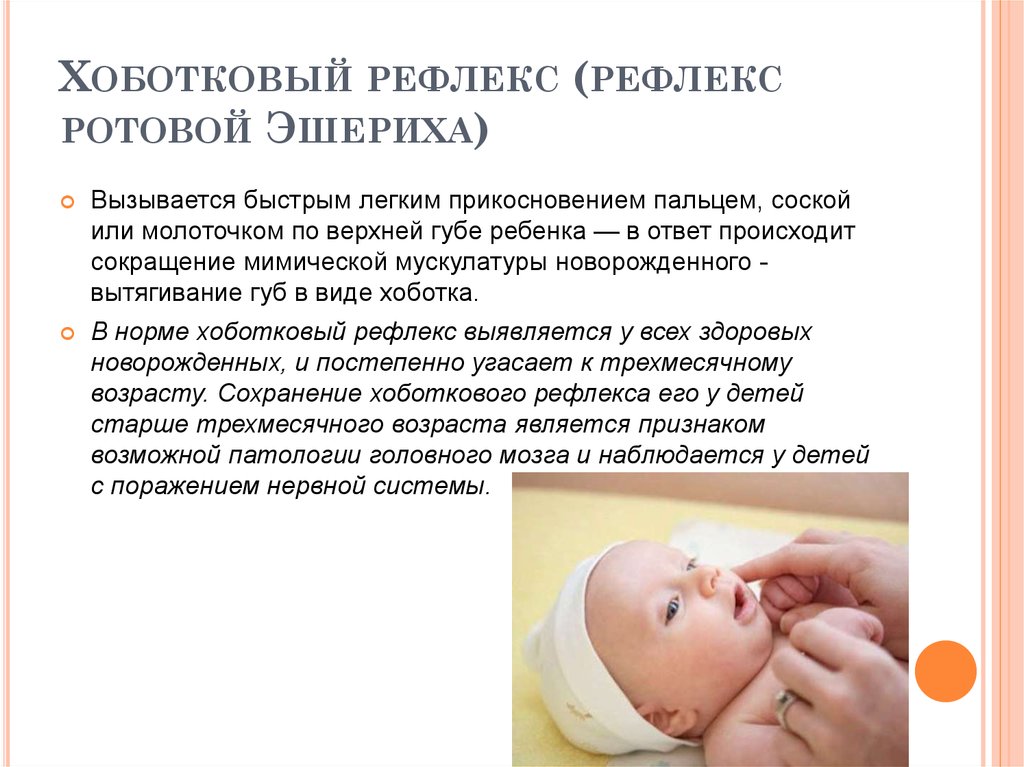 Как проверить рефлексы. Поисковый и хоботковый рефлекс у новорожденного. Хоботковый рефлекс у новорожденных. Поисково сосательный рефлекс новорожденного. Сосательный рефлекс, хоботковый рефлекс.