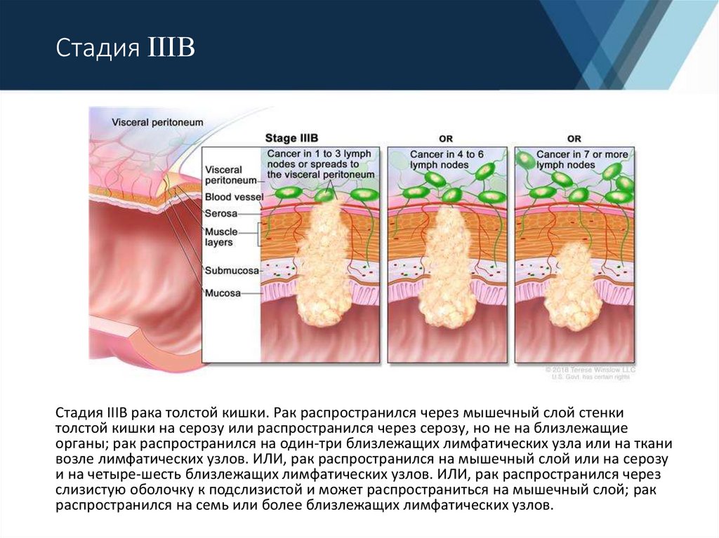 Рак 4 стадия прогноз. Мышечный слой толстой кишки. Стадия III B. Онкология соседних органов.