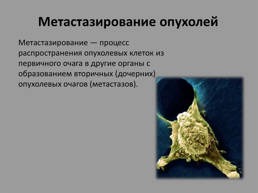 Рак презентация. Метастазирование опухолей. Метастазирование злокачественных новообразований:. Разновидности метастазирования опухолей. Метастазирование опухолей схема.