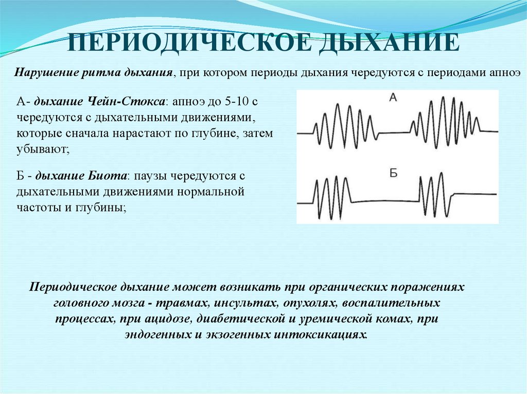 Типы дыхания