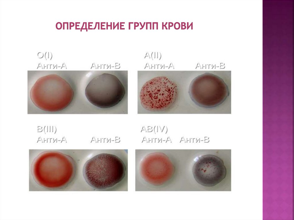 Определение группы крови и резус цоликлонами. Цоликлон группа крови резус. Определение группы крови цоликлонами таблица. Определение группы и Резуса.