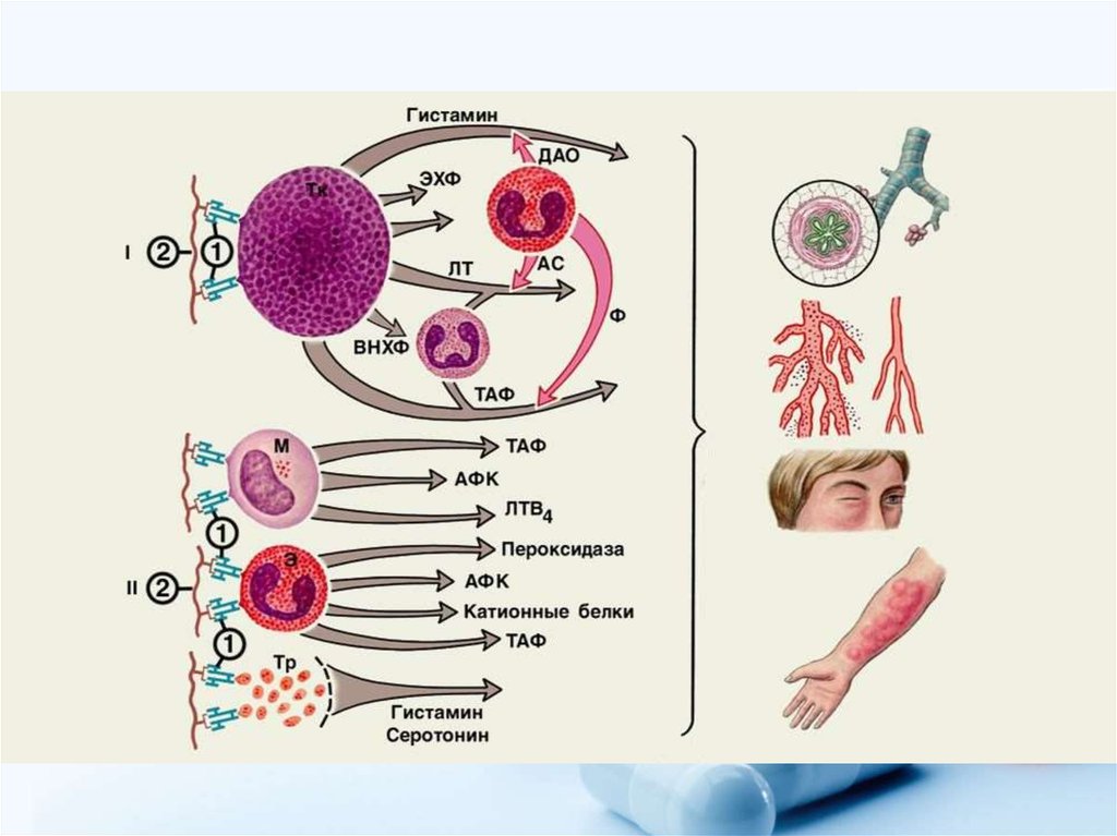 Иммунология аллергический. Стадии развития аллергических реакций 1 типа иммунология. Схема аллергической реакции. Анафилактический Тип аллергических реакций. Схемы типов аллергий.
