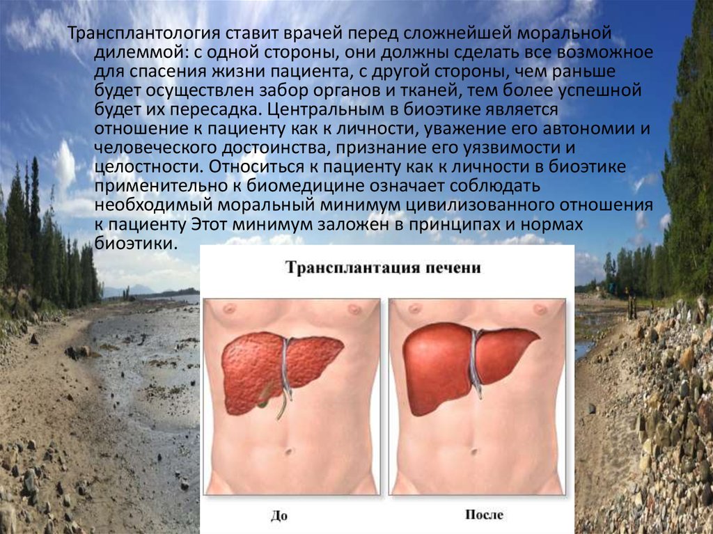 Трансплантация за и против презентация