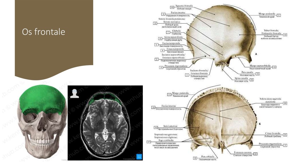 Facies medialis dentium incisivorum et caninorum