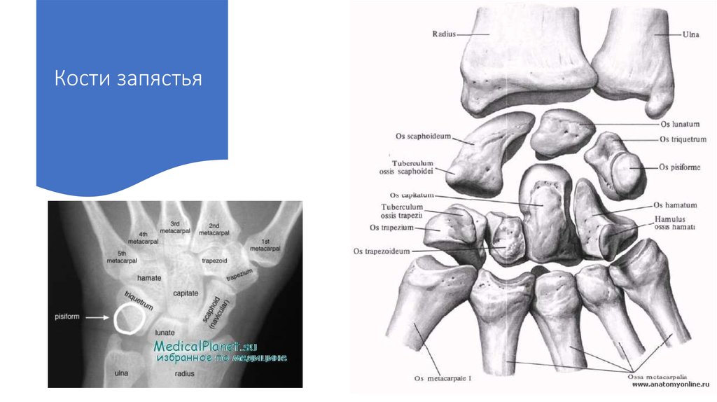 Кости запястья отдел. Кости запястья. Гороховидная кость запястья. Соотношение костей в лучезапястном суставе. Проксимальный ряд костей запястья состоит из.