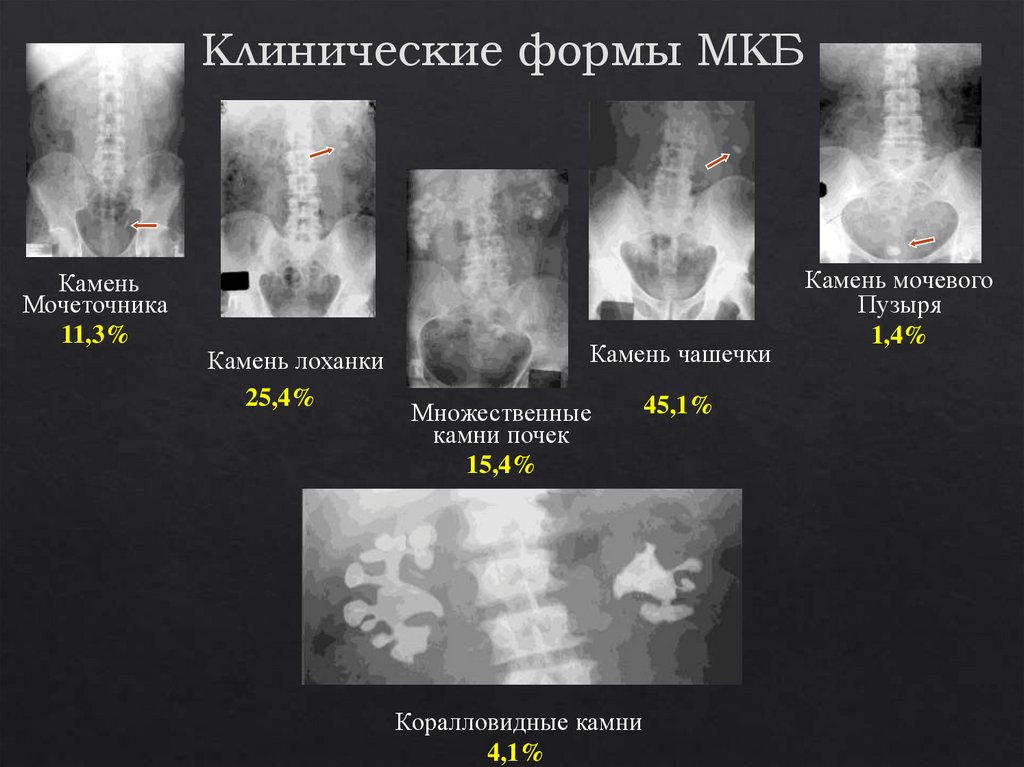 Мочекаменная болезнь у кошек картинки