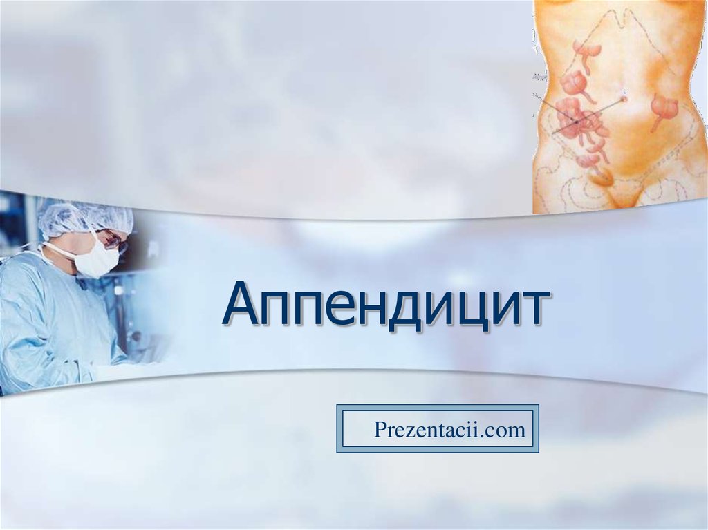 Хронический аппендицит презентация