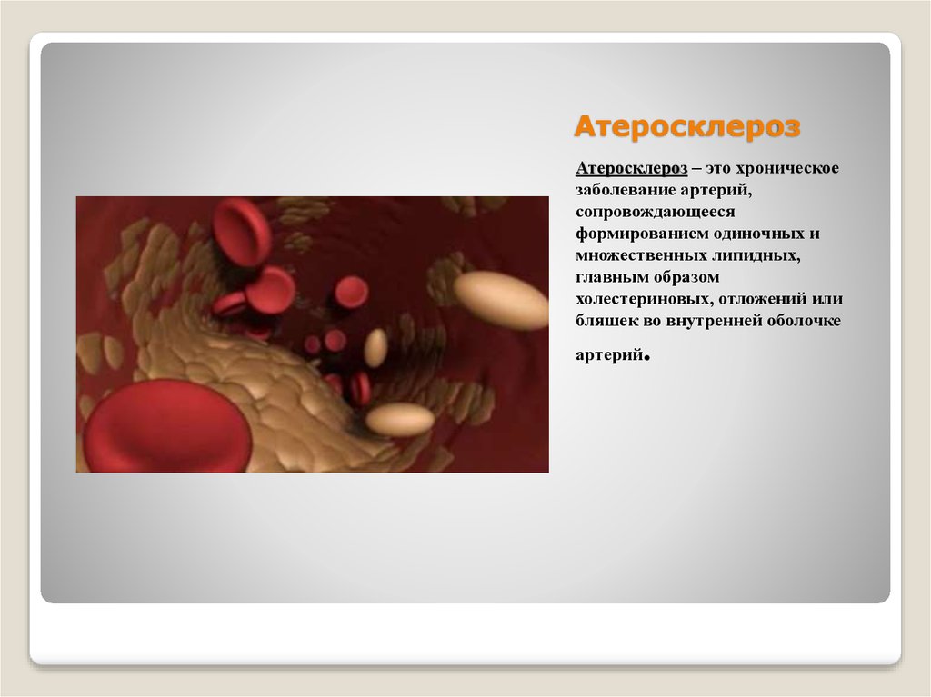 Артерий атеросклероз латынь. Атеросклероз презентация. Атеросклероз это хроническое заболевание.