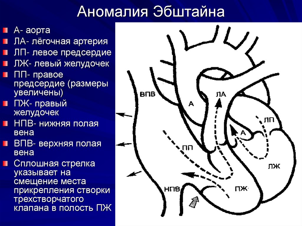 Деление легочной артерии схема