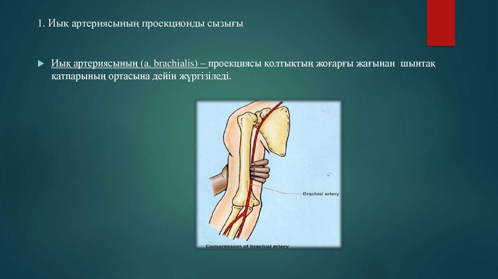 1. Иық артериясының проекционды сызығы
