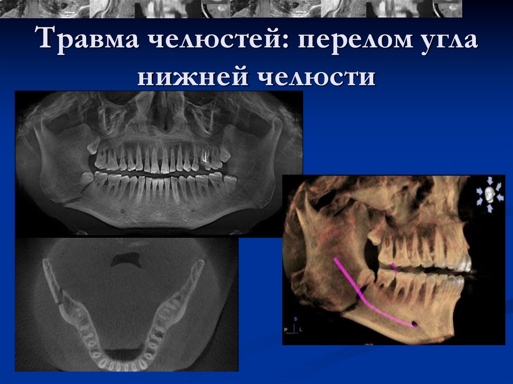 Мрт в стоматологии презентация