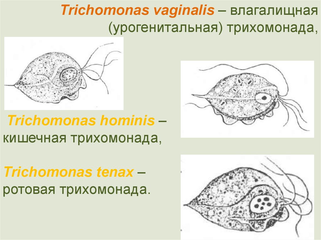 Трихомонада кишечная. Trichomonas Tenax строение. Трихомонада урогенитальная строение. Трихомонада ротовая - Trichomonas Tenax. Кишечная и урогенитальная трихомонада.