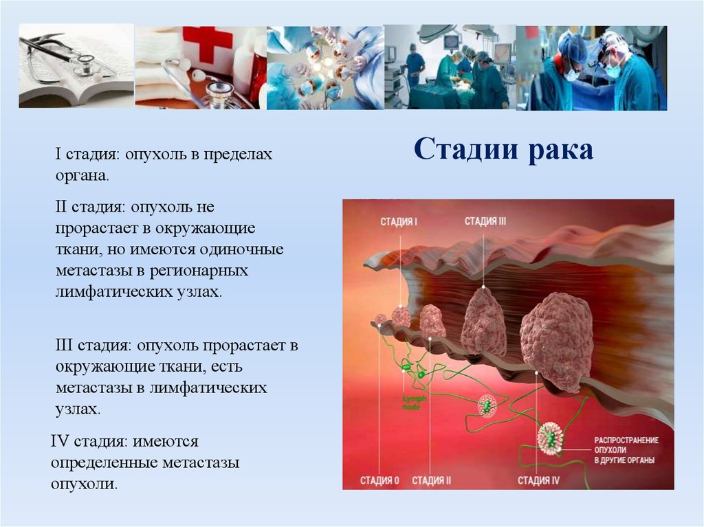 Рак 1. Стадии новообразований. Степень опухоли. Стадии опухолевых заболеваний. Стадии онкологических заболеваний.