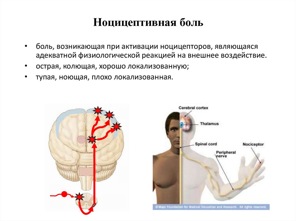 Что характерно для болевых ноцицептивных ощущений