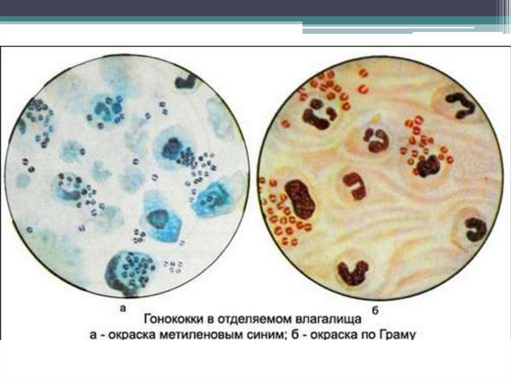 Микроскопическая картина u норма