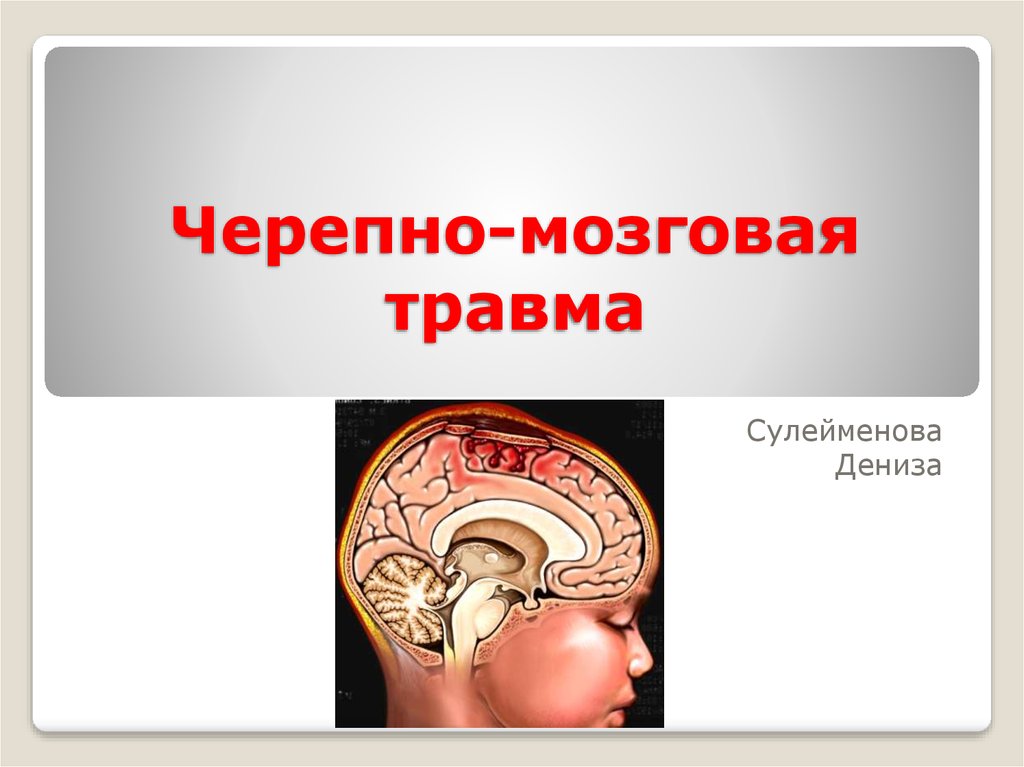 Чмт неврология презентация