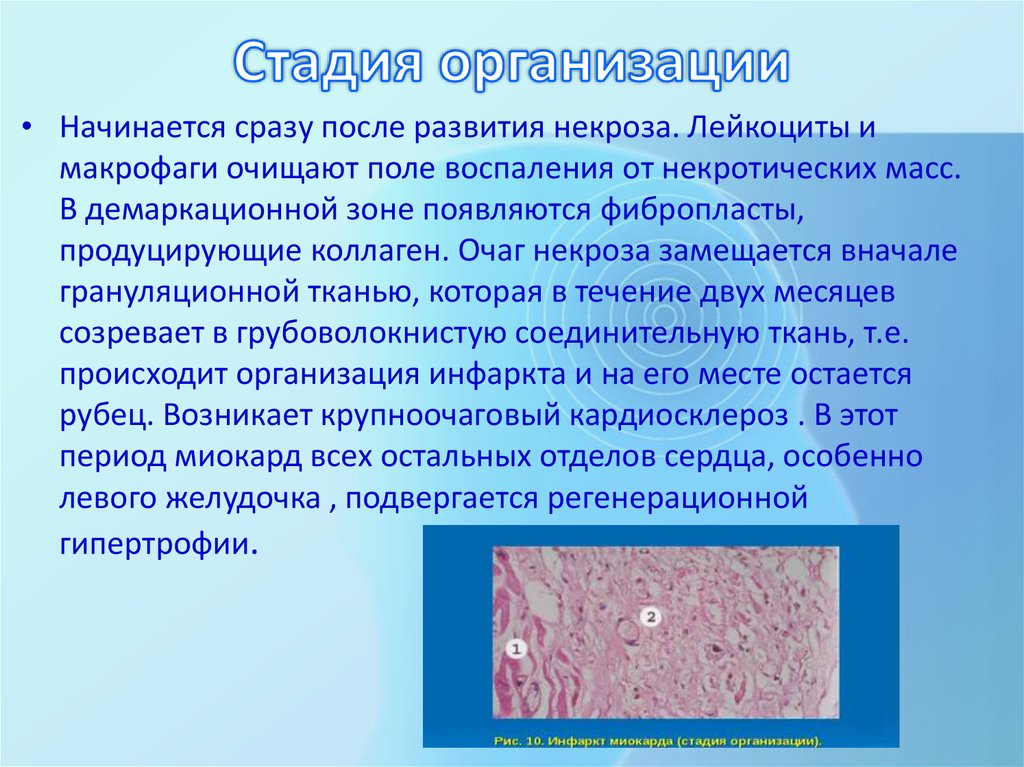 Стадии организации