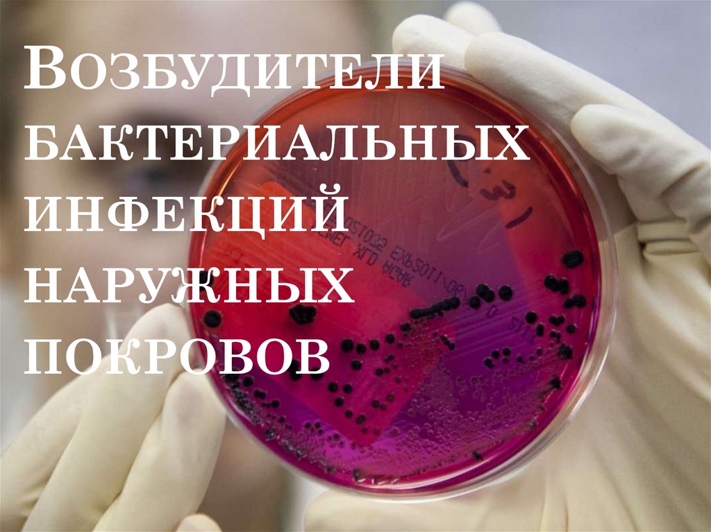 Реферат: Возбудители бактериальных инфекций человека