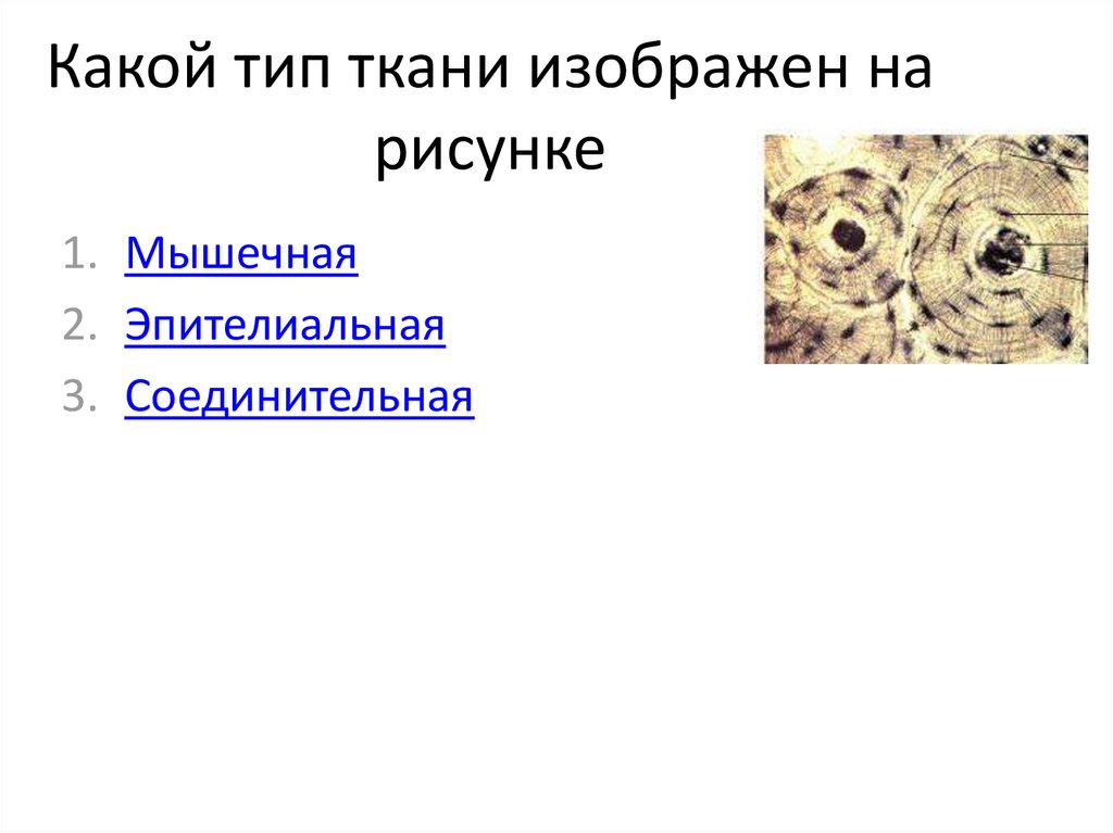 К какому типу ткани относится. Какой Тип ткани изображён на рисунке?. Какая ткань изображена на рисунке. Какие виды соединительных тканей изображены на рисунке.