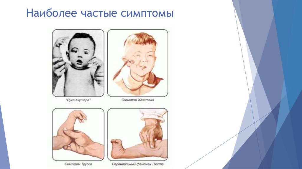 Спазмофилия презентация по педиатрии